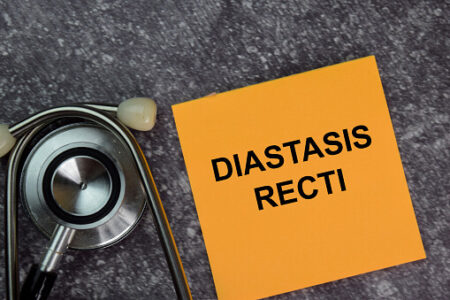 What is Diastasis Recti